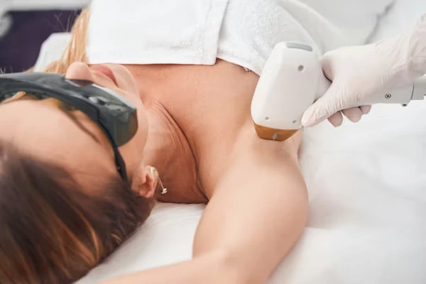Laser Hair Reduction: Sessions, Results and What to Expect